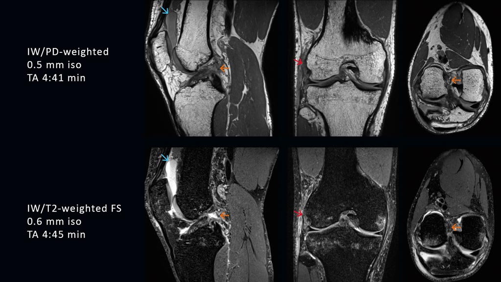Image: High-resolution 3D isotropic images using the GOKnee3D app (Photo courtesy of Siemens Healthineers). Image: High-resolution 3D isotropic images using the GOKnee3D app (Photo courtesy of Siemens Healthineers).