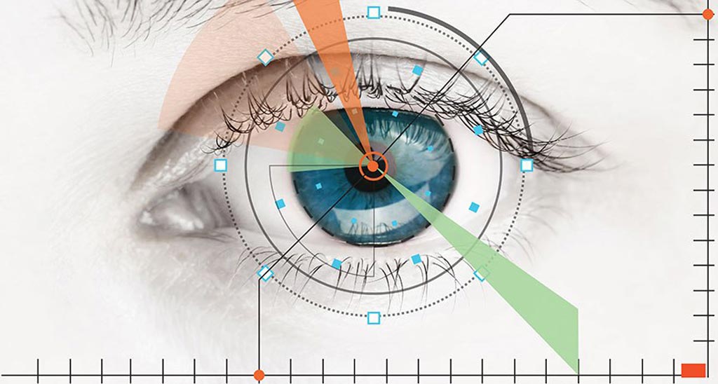Image: The IDx-DR system is designed to analyze images of the eye taken with a retinal camera and detect diabetic retinopathy (Photo courtesy of IDx).