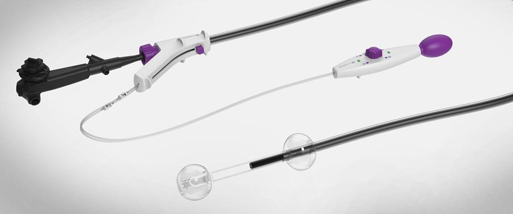 Image: An endoscopic accessory stabilizes endoluminal procedures (Photo courtesy of Lumendi).