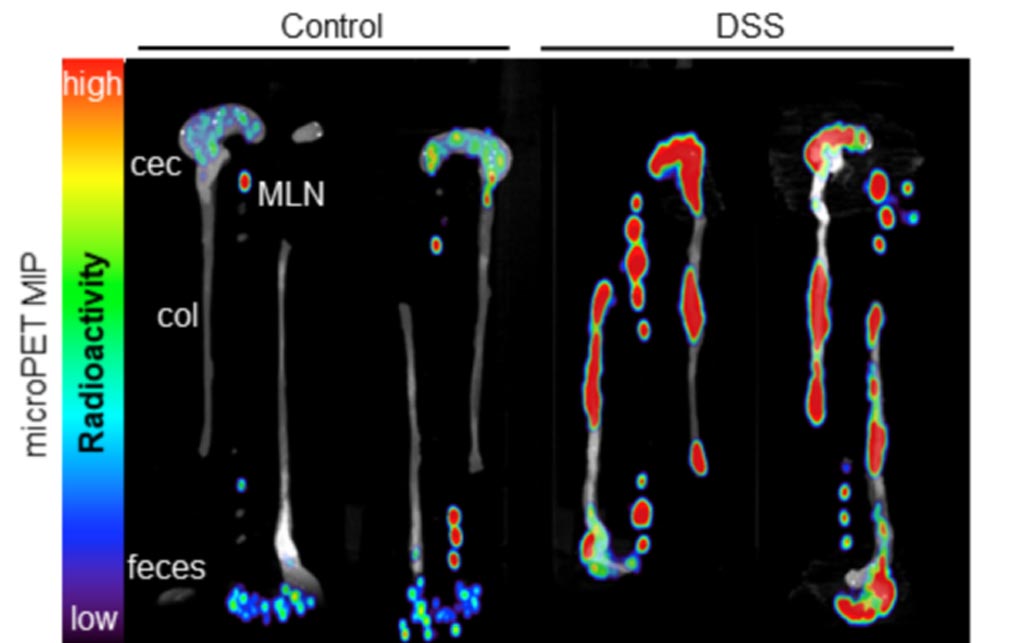 Image: Ex vivo images of colons, ceca, and mesenteric lymph nodes taken via the immunoPET platform (Photo courtesy of UCLA).