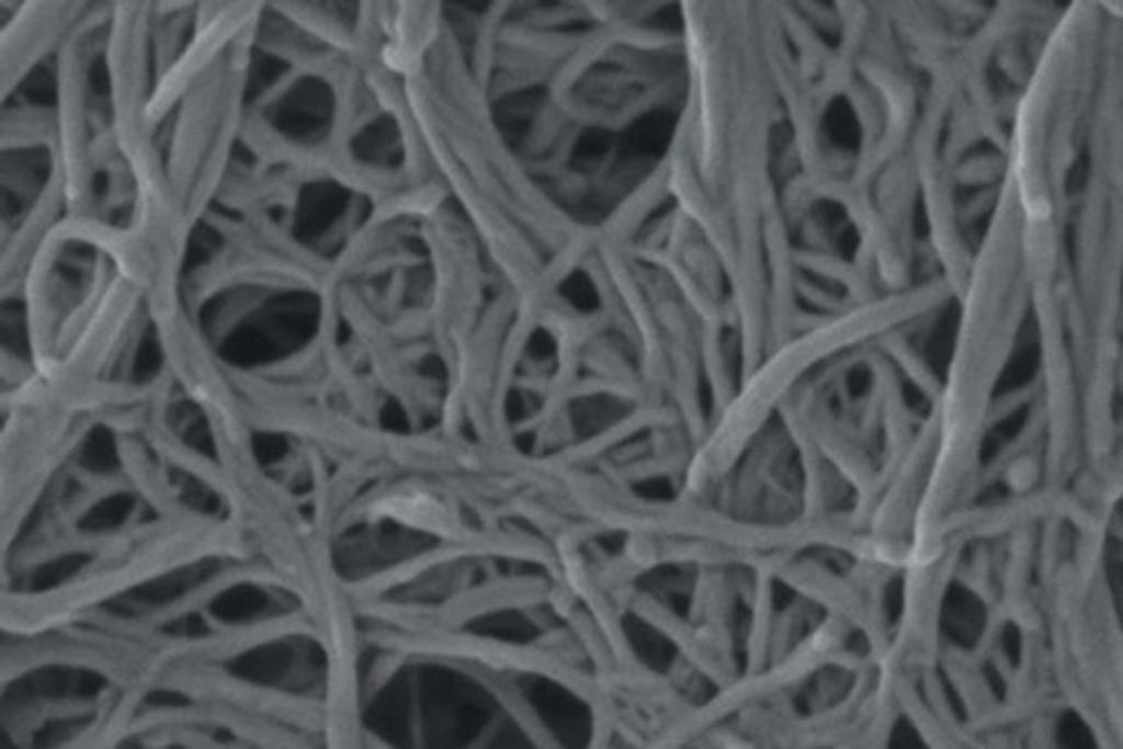 Image: Electrospun nanofiber wound dressings containing vitamin D battle infections (Photo courtesy of OSU).