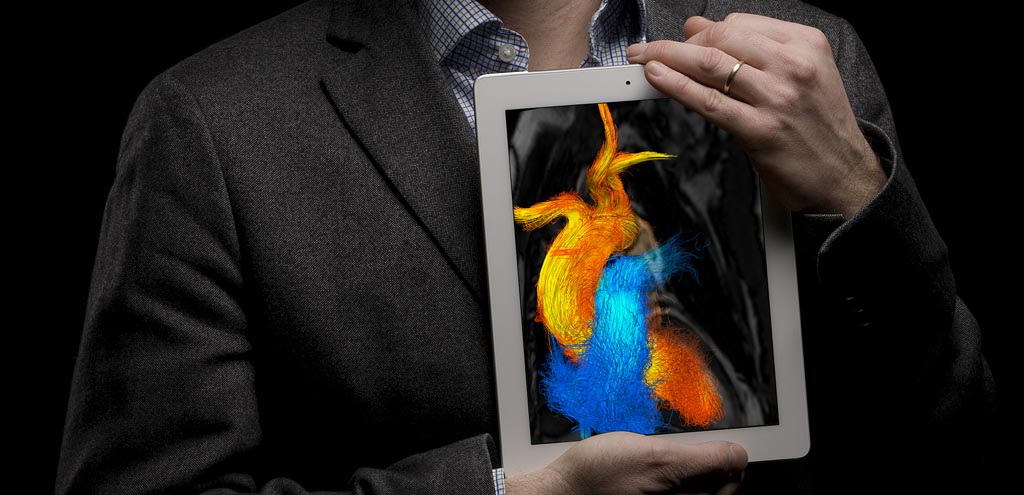 Image: Cardiac flow patterns can now be derived from CT alone (Photo courtesy of Oscar Luren / LiU).