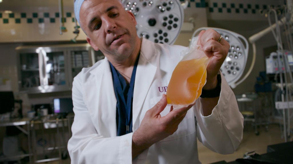 Image: Professor Jason Sperry holding a bag of thawed plasma (Photo courtesy of Tim Betler/UPMC).