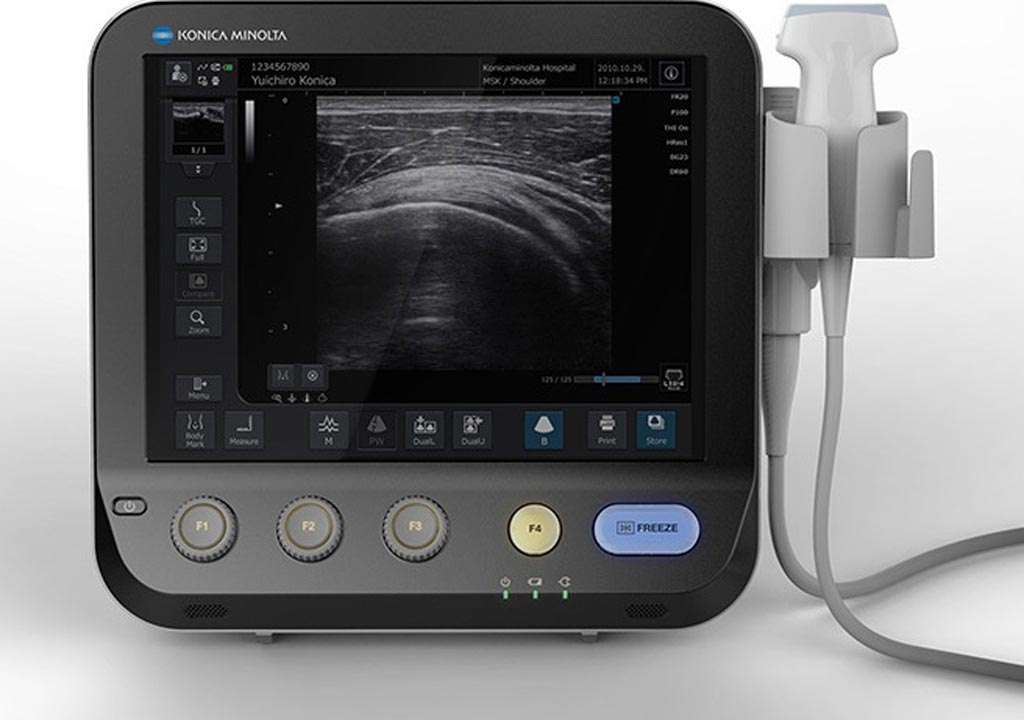 Image: The SonImage MX1 portable Uutrasound system (Photo courtesy of Konica Minolta). Image: The SonImage MX1 portable Uutrasound system (Photo courtesy of Konica Minolta).