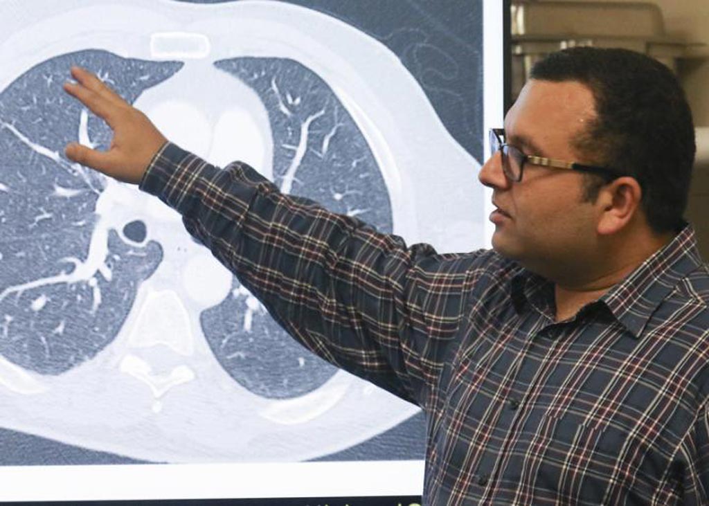 Image: Assistant Professor Ulas Bagci leads the group of engineers at the University of Central Florida that have taught a computer how to detect tiny specks of lung cancer in CT scans, which radiologists often have a difficult time identifying. The artificial intelligence system is about 95 percent accurate, compared to 65 percent when done by human eyes, the team said (Photo courtesy of the University of Central Florida, Karen Norum).