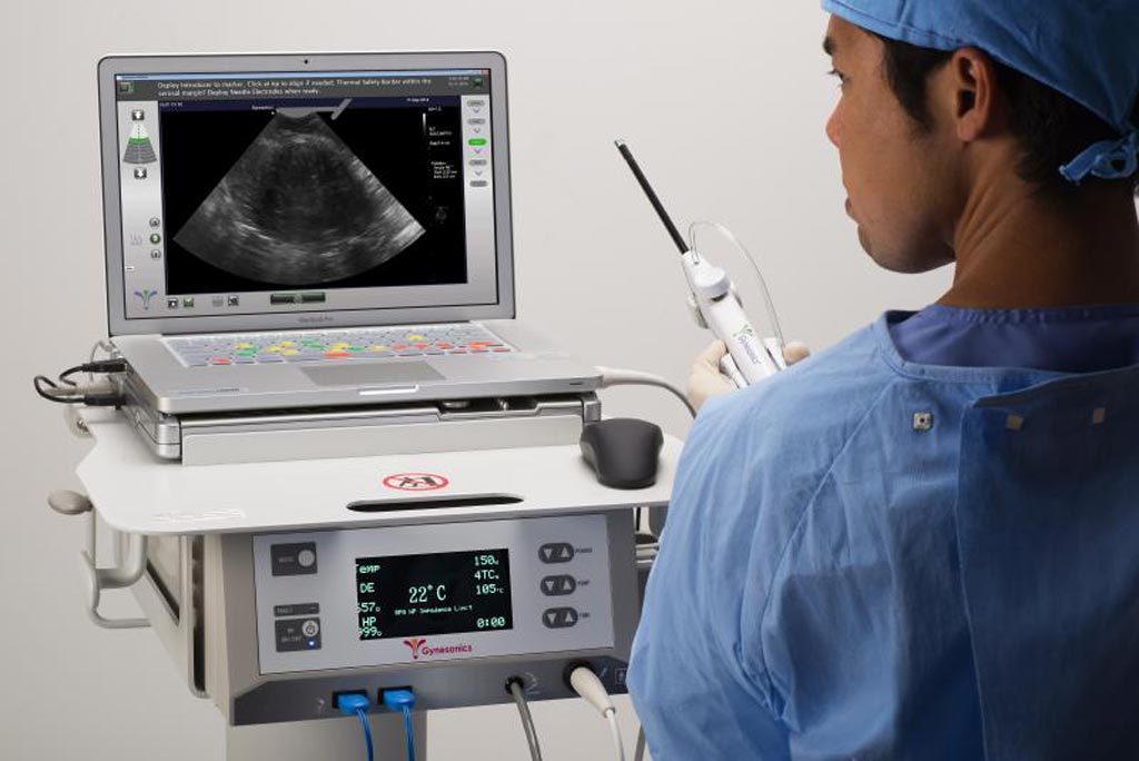 Image: The Sonata sonography-guided transcervical fibroid ablation system (Photo courtesy of Gynesonic).