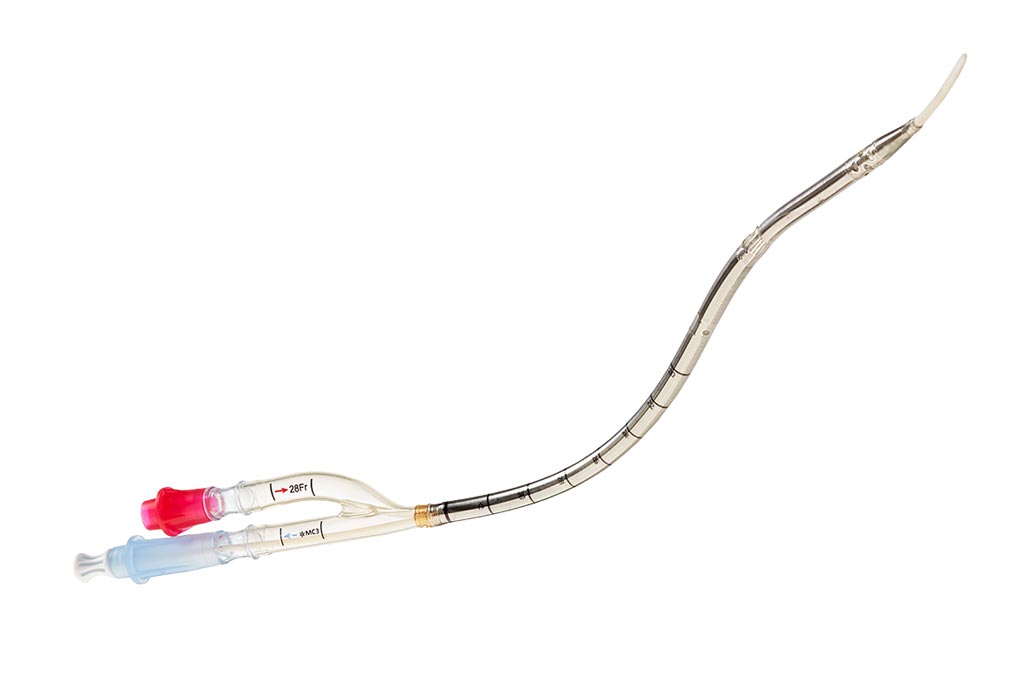 Image: The Crescent Jugular dual lumen catheter (Photo courtesy of MC3 Cardiopulmonary).