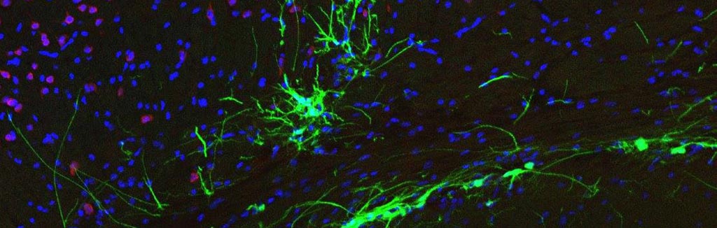 Image: Dormant cervical neurons can kick start breathing following spinal cord injury (Photo courtesy of Fehlings Lab, UT).