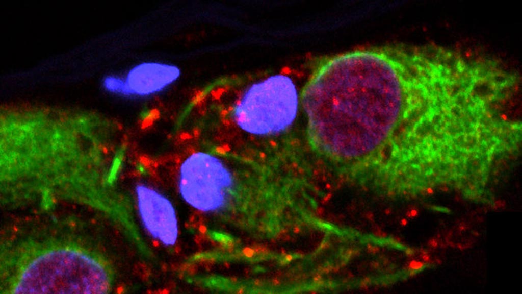 Image: A microscope image of α-synuclein clumps in the appendix (in red) (Photo courtesy of VARI).