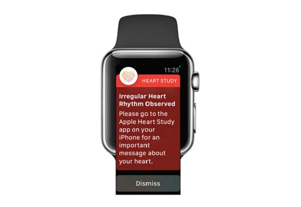 Image: The Apple Watch may soon detect AF and other arrhythmias (Photo courtesy of Stanford University).