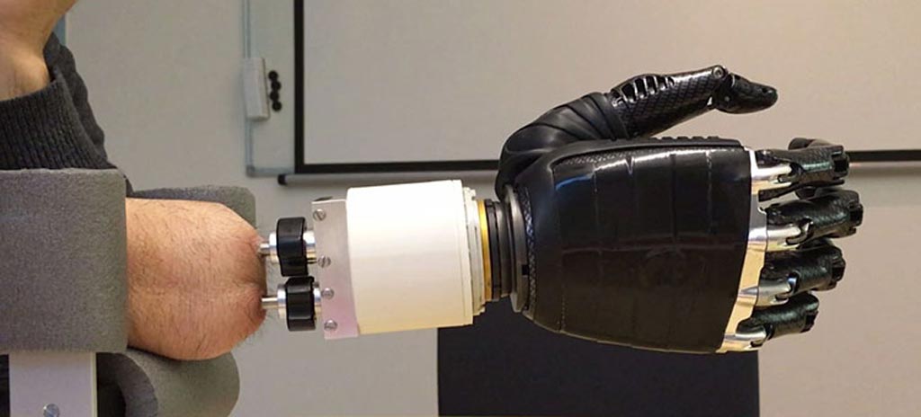 Image: A wrist-like artificial joint acts interfaces between osseointegrated implants and a prosthetic hand (Photo courtesy of Chalmers University of Technology).