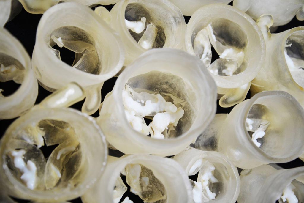Image: Physical 3D printed models of patient aortic heart valves (Photo courtesy of Wyss Institute).
