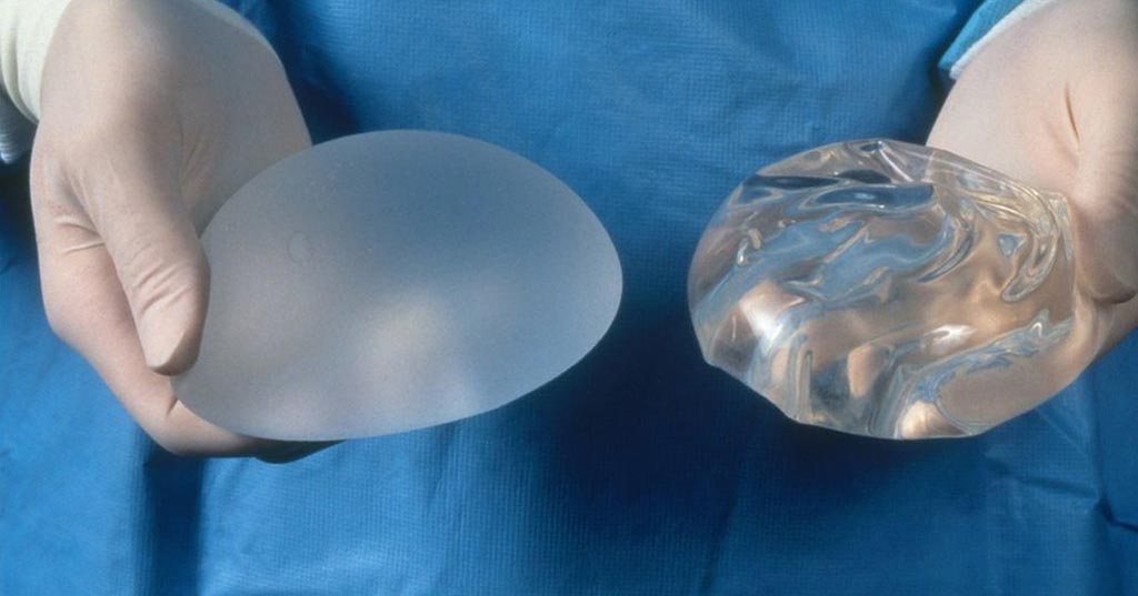 Силиконовый и солевой грудные имплантаты (фото предоставлено Science Photo Library).