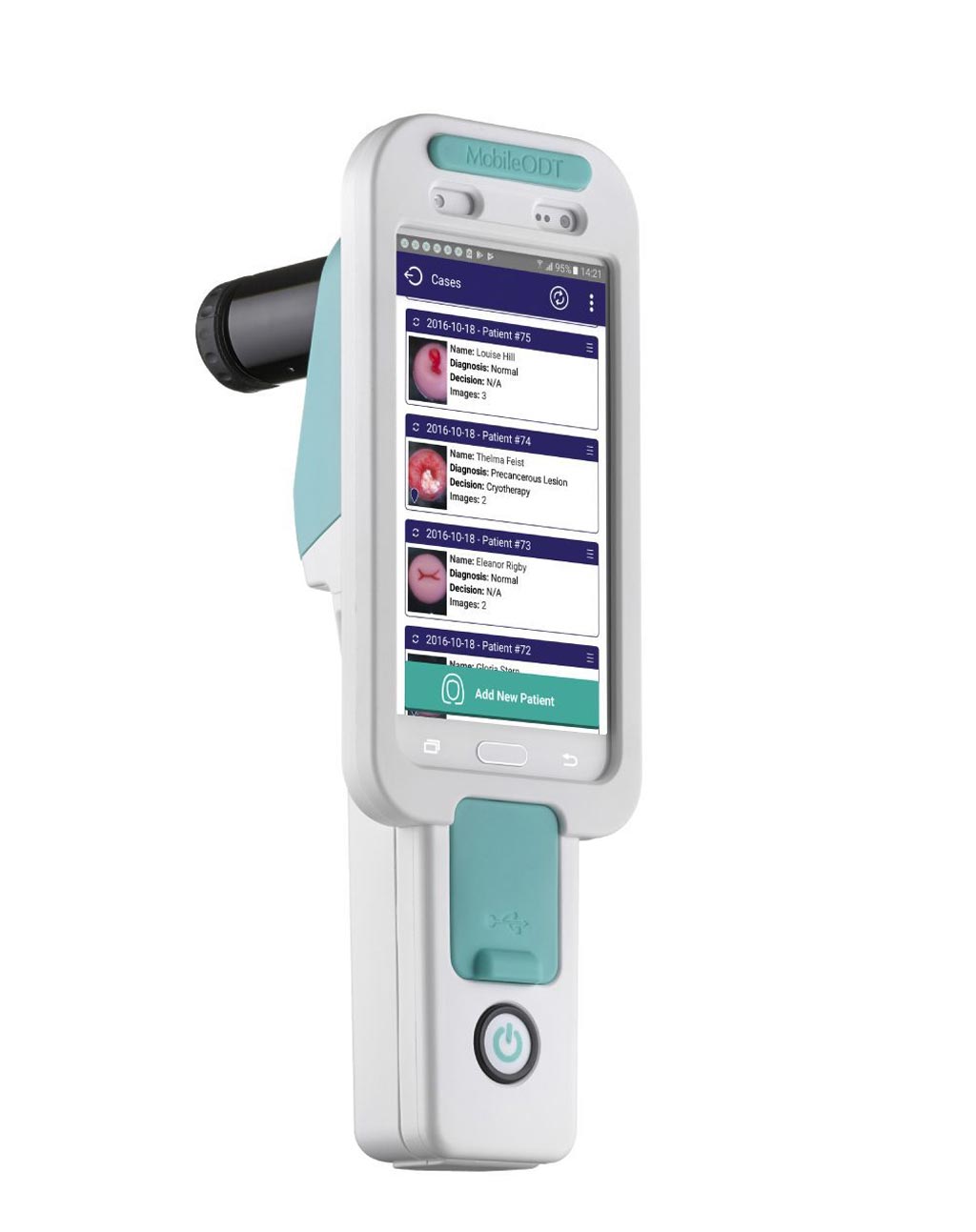Image: The EVA3 mobile colposcope, with smartphone attached (Photo courtesy of MobileODT).