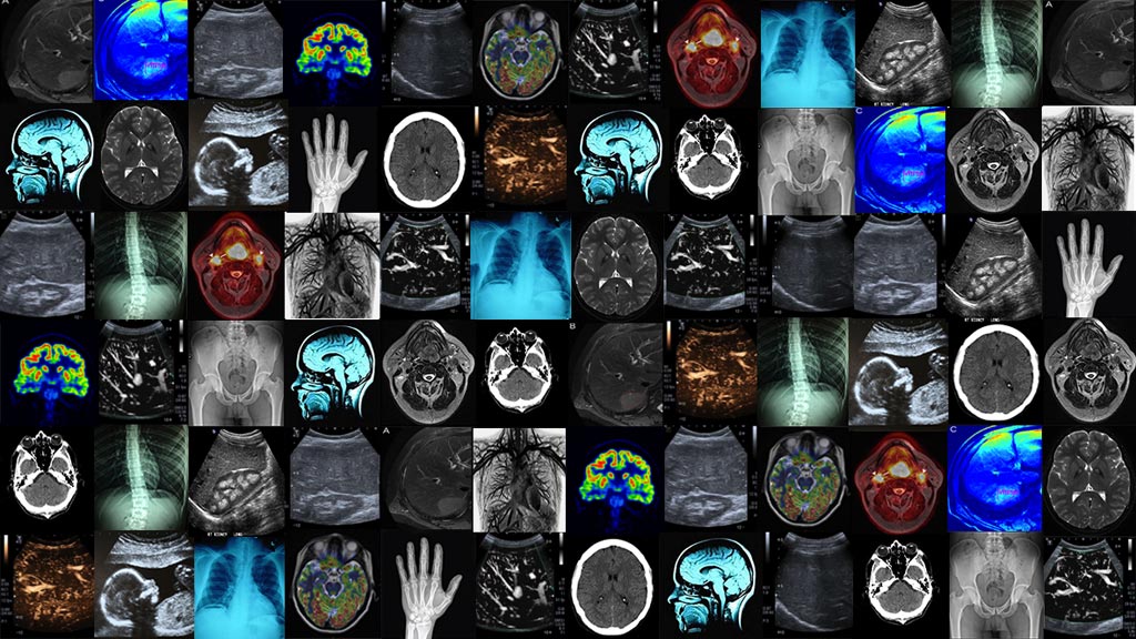 Image: A new study finds most imaging professionals regard ML as important to their industry for the future (Photo courtesy of Imperial College London).