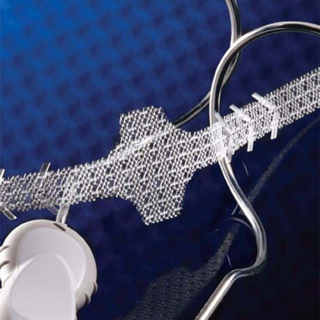 Image: The AdVance XP male sling system (Photo courtesy of Boston Scientific).