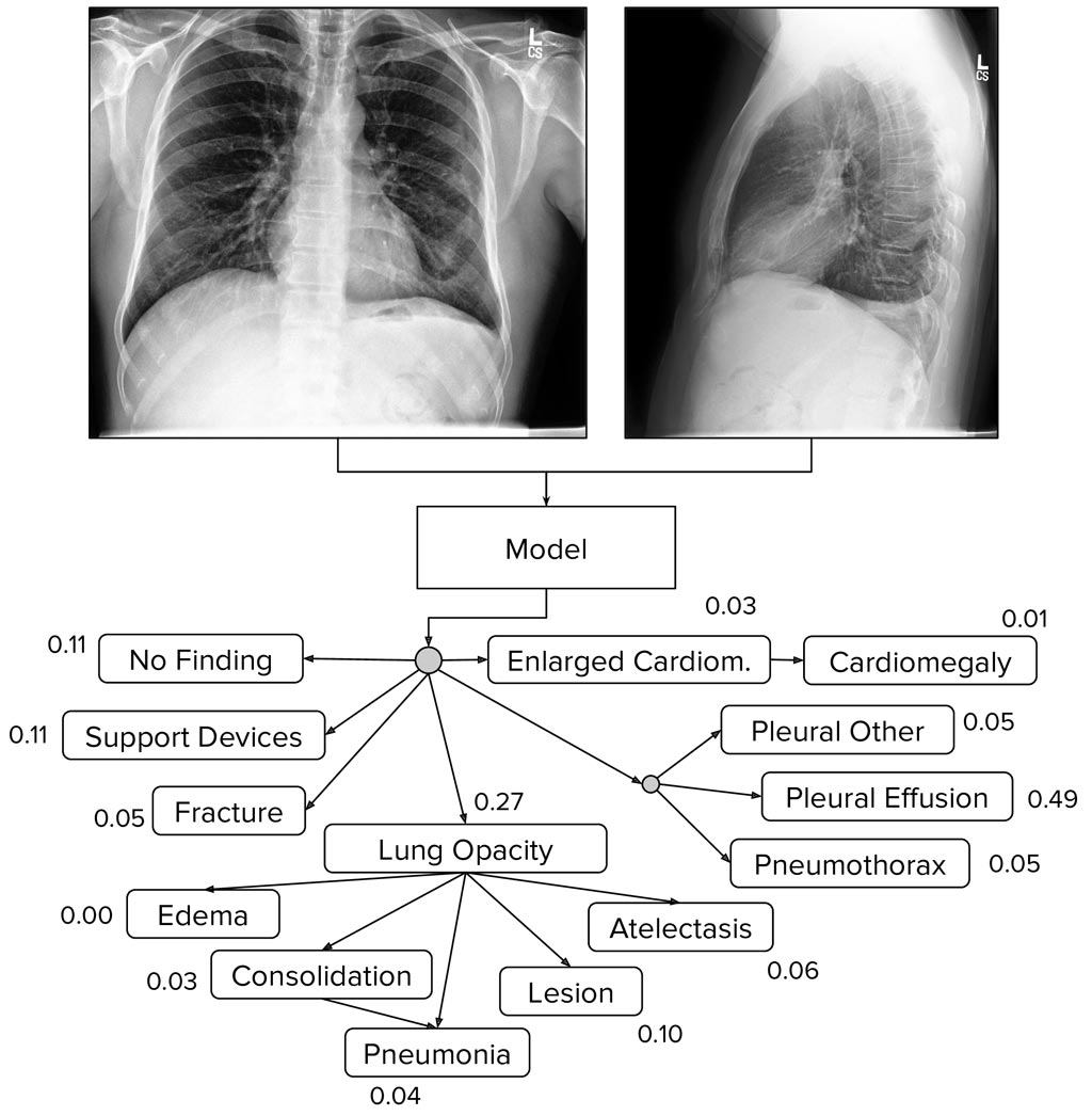 Image: The CheXpert dataset of chest X-rays is designed for automated chest X-ray interpretation (Photo courtesy of Stanford University School of Medicine).