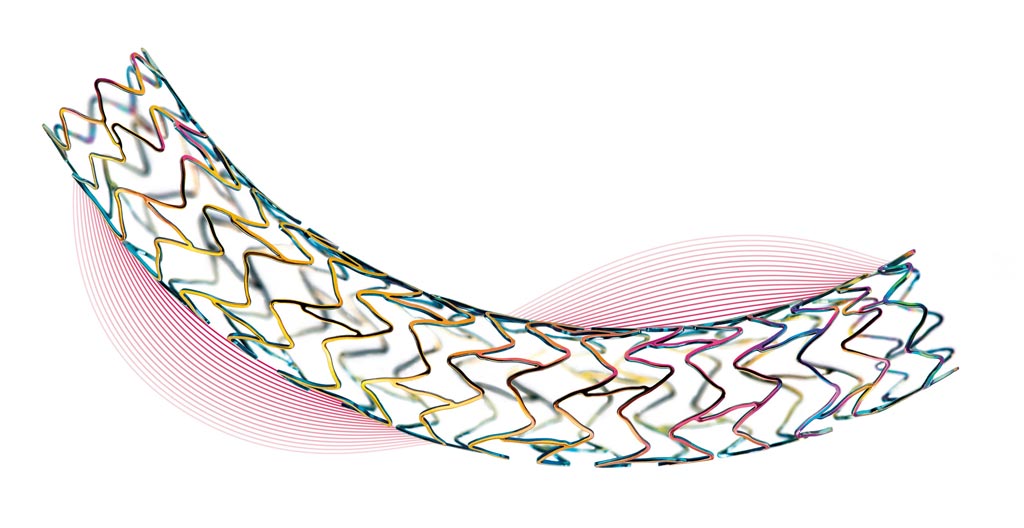 Image: A double helix-shaped stent provides increased flexibility (Photo courtesy of BIOTRONIK).