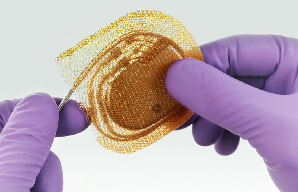 Image: The TYRX absorbable antibacterial envelope (Photo courtesy of Medtronic).