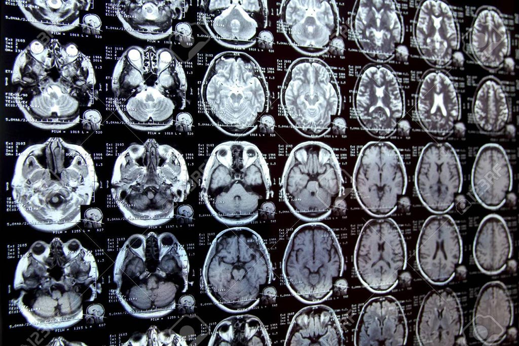 Image: ZTE MRI shows results similar to CT scanning (Photo courtesy of 123rf). Image: ZTE MRI shows results similar to CT scanning (Photo courtesy of 123rf).