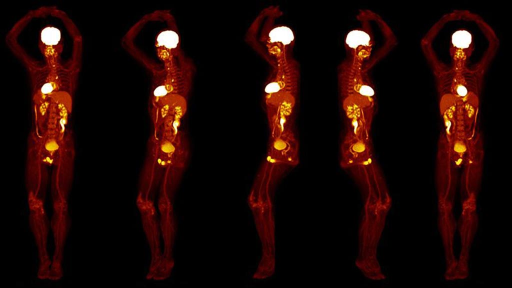 Image: Whole-body PET scans can now be done in 20 seconds (Photo courtesy of UCD). Image: Whole-body PET scans can now be done in 20 seconds (Photo courtesy of UCD).