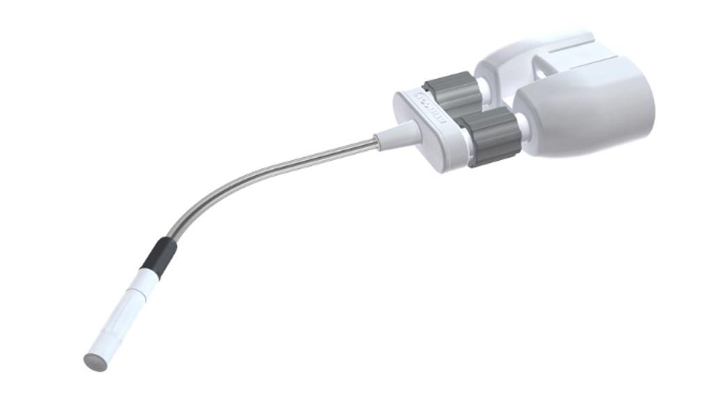 Image: The Vistaseal laparoscopic dual applicator (Photo courtesy of Ethicon).