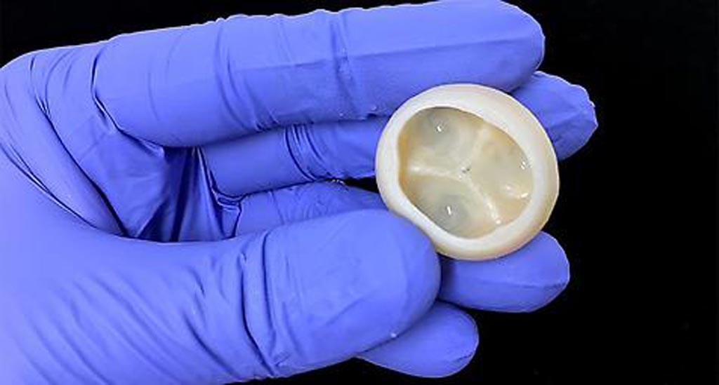 Image: A trileaflet heart valve 3D printed using FRESH (Photo courtesy of CMU).