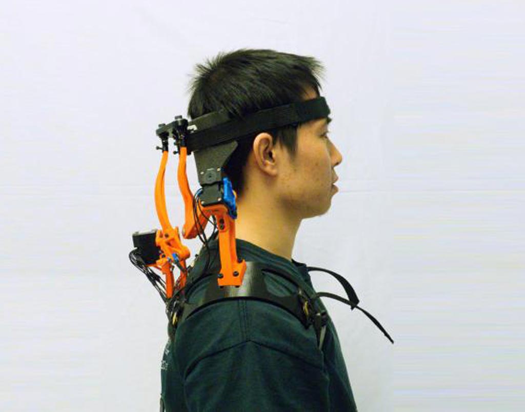 Image: A dynamic neck brace helps ALS patients support their head (Photo courtesy of Columbia University).