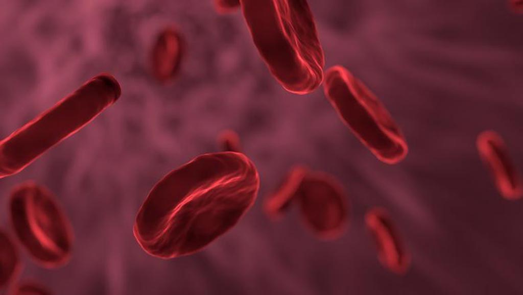 Image: Statistics from a new study show bloodstream ICU infections in the UK have dropped drastically (Photo courtesy of 123rf.com).