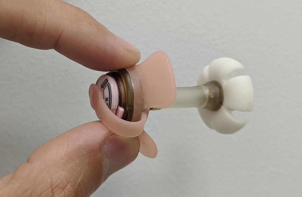 Image: The Fidmi Medical low-profile PEG tube (Photo courtesy of Fidmi Medical).
