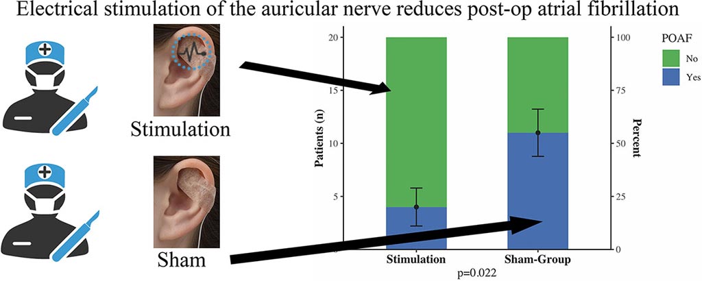 Image: Graphical abstract of the study (Photo courtesy of Martin Andreas / MedUniWien).