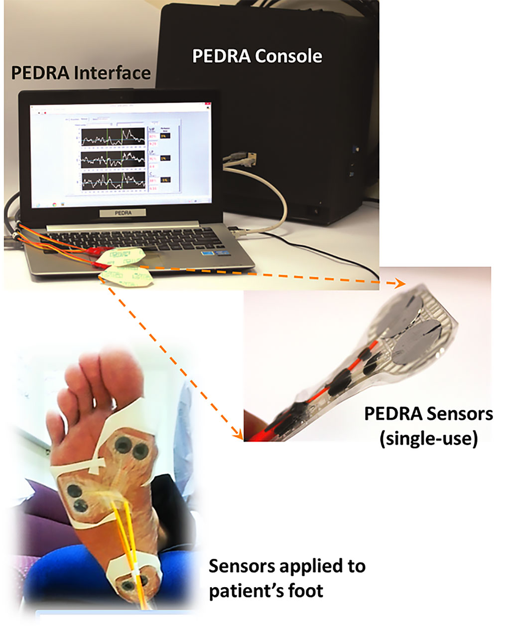 Image: The Pedra real-time tissue perfusion monitor (Photo courtesy of Pedra Technology)