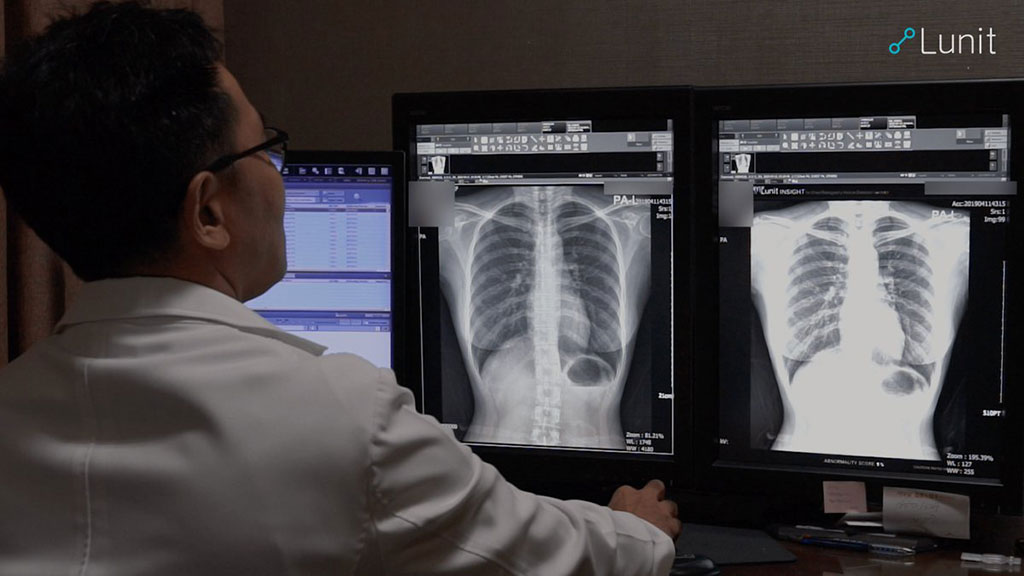 Image: Lunit INSIGHT CXR (Photo courtesy of Lunit) Image: Lunit INSIGHT CXR (Photo courtesy of Lunit)