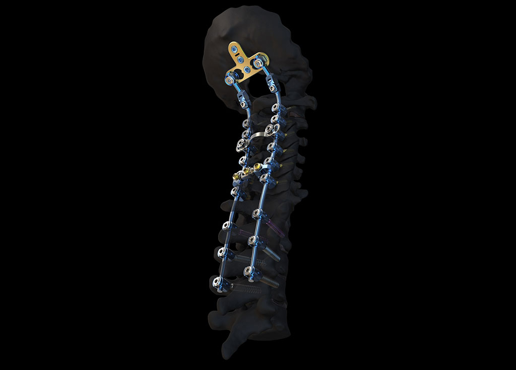 Image: The Symphony OCT fusion system (Photo courtesy of DePuy Synthes)
