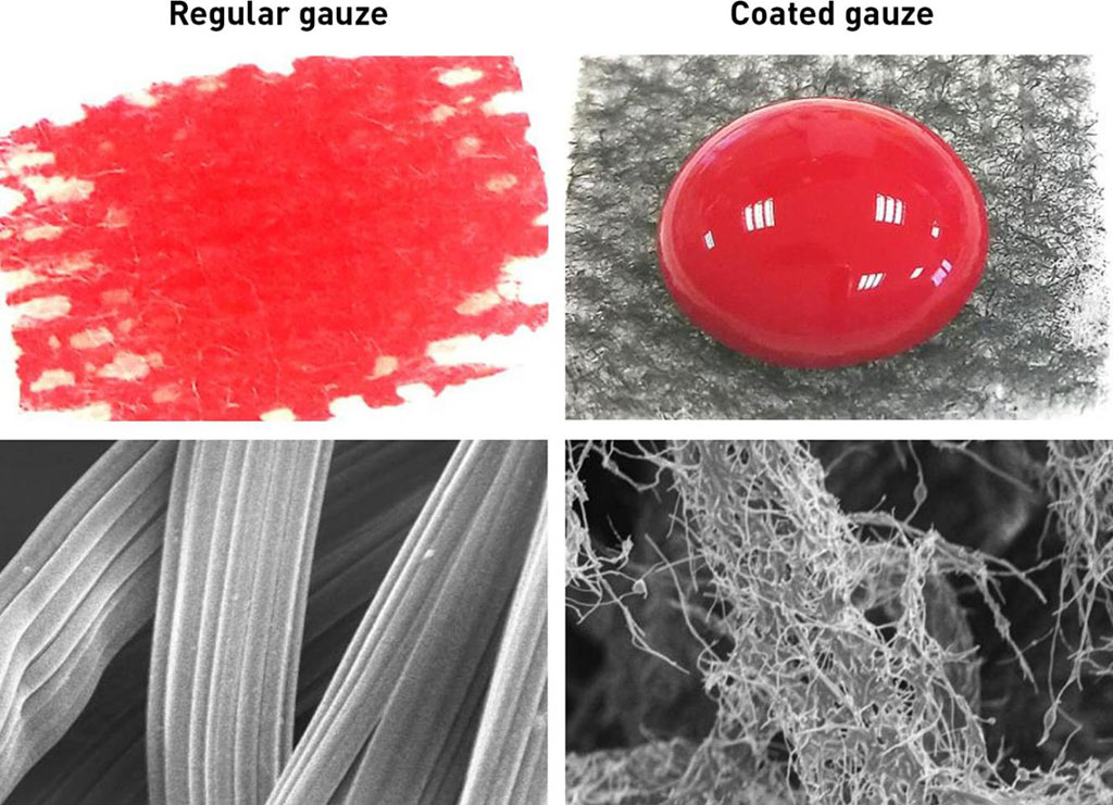 Image: Regular cotton gauze (L) compared to gauze coated with CNF (R) (Photo courtesy of Nature Communications)
