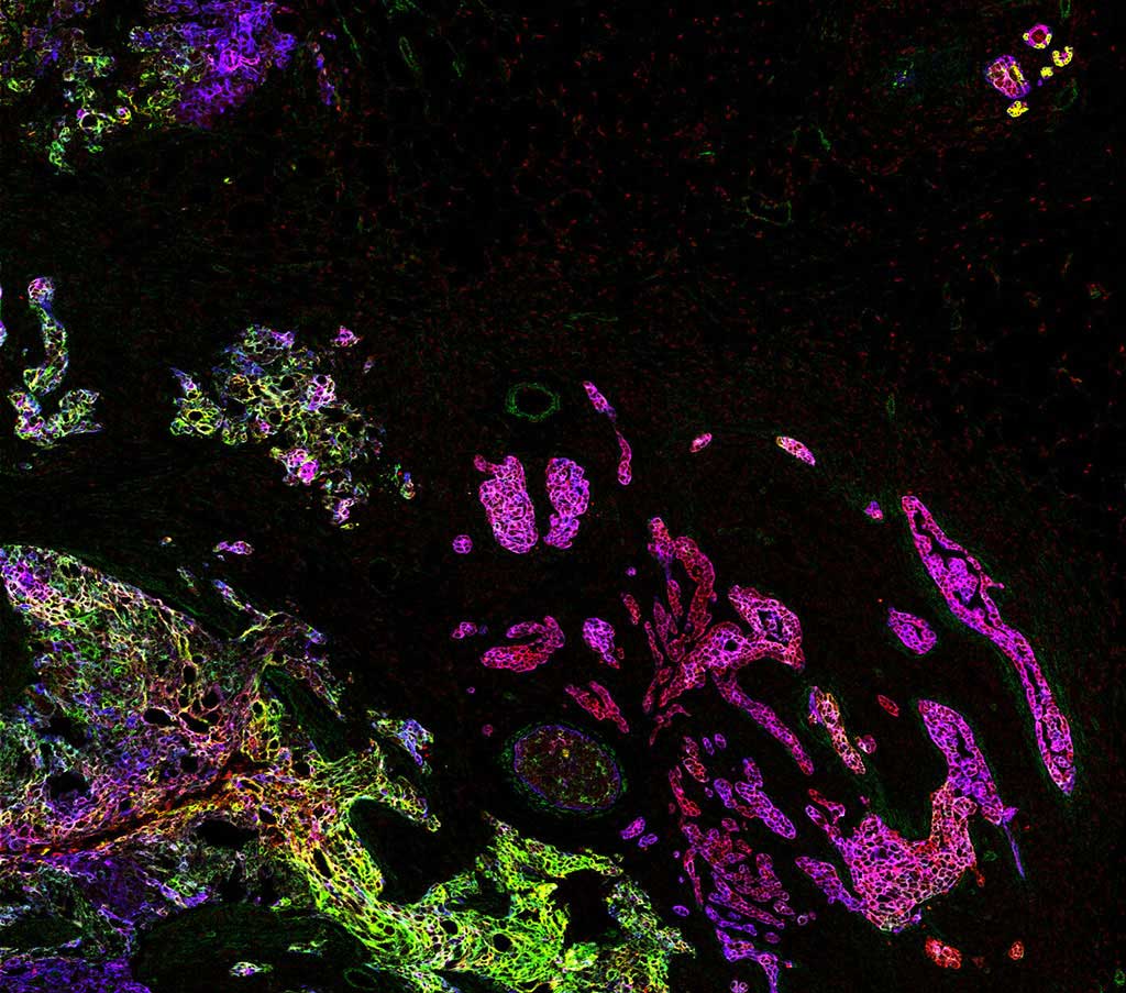 Image: Mass cytometry can generate information-rich digital images (Photo courtesy of Bernd Bodenmiller/ UZH) Image: Mass cytometry can generate information-rich digital images (Photo courtesy of Bernd Bodenmiller/ UZH)