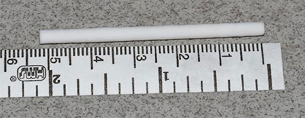 Image: The 5.2 cm GDNF-releasing nerve guide (Photo courtesy of Pitt)