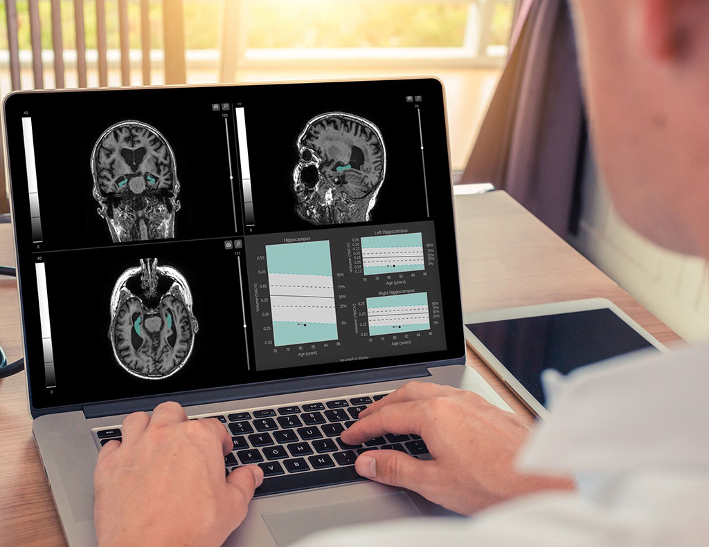 Image: A software platform aids early detection of neurodegenerative diseases (Photo courtesy of Qynapse) Image: A software platform aids early detection of neurodegenerative diseases (Photo courtesy of Qynapse)