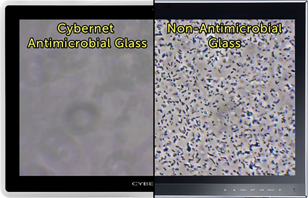 Image: Antimicrobial glass reduces touch-screen colonization (Photo courtesy of Cybernet)