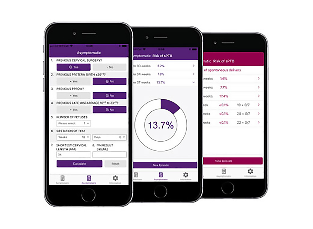 Image: The QUiPP v2 app can calculate pre-term birth risk (Photo courtesy of GeneticApps)