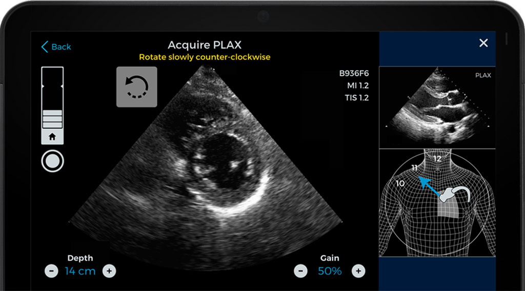 Image: Caption Guidance software (Photo courtesy of Caption Health)