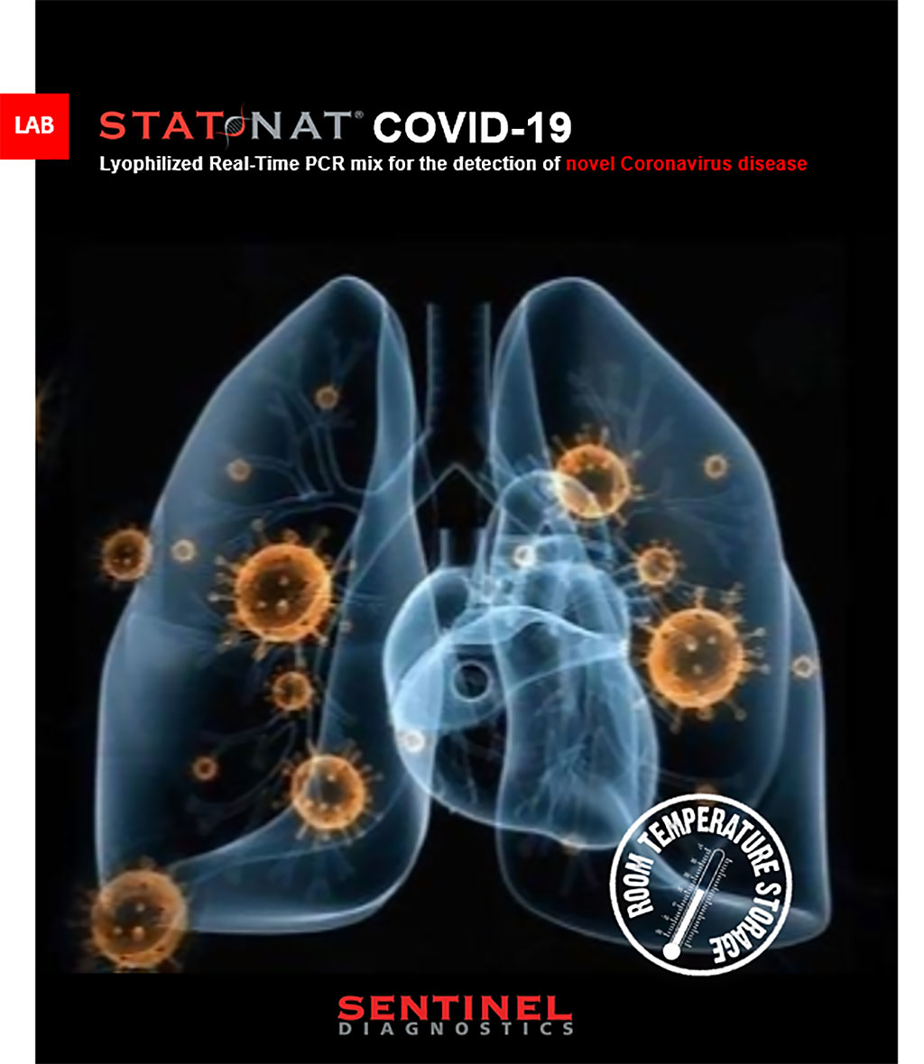 Image: STAT-NAT® COVID-19 Assay (Photo courtesy of Sentinel Diagnostics)