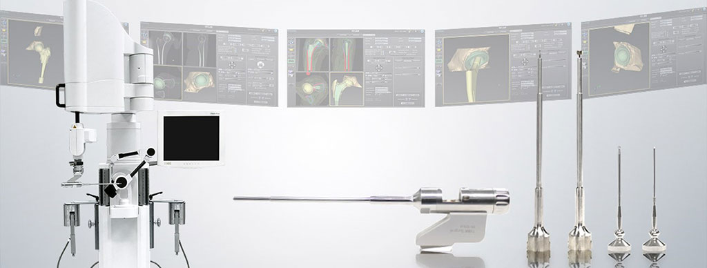 Image: The TSolution One Surgical System advances joint replacement procedures (photo courtesy of THINK Surgical)