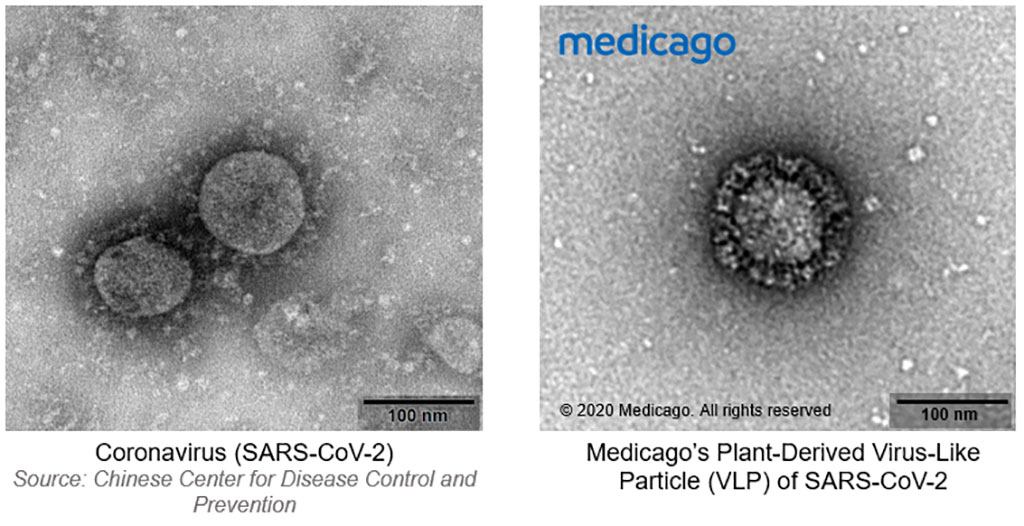 Image: Plant-based vaccine for COVID-19 could prevent novel coronavirus spread (Photo courtesy of Medicago, Inc.)