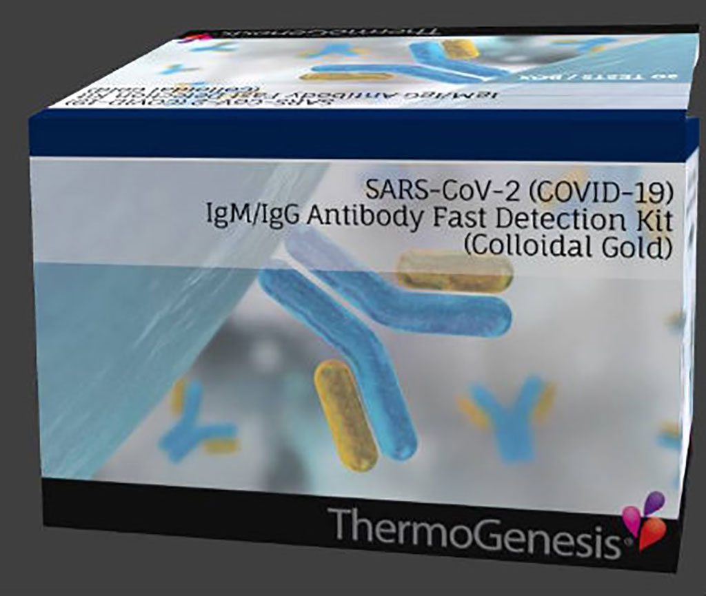 Image: SARS-CoV-2 (COVID-19) IgM/IgG Antibody Fast Detection Kit (Photo courtesy of ThermoGenesis Holdings, Inc.)