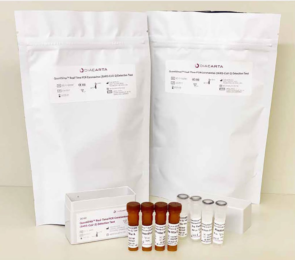Image: DiaCarta’s QuantiVirus PCR Diagnostic Test (Photo courtesy of DiaCarta Inc.) Image: DiaCarta’s QuantiVirus PCR Diagnostic Test (Photo courtesy of DiaCarta Inc.)