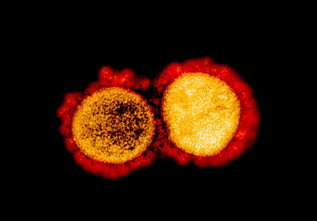 Image: This transmission electron micrograph shows SARS-CoV-2 virus particles isolated from a patient suffering from COVID-19 (Photo courtesy of NIAID).