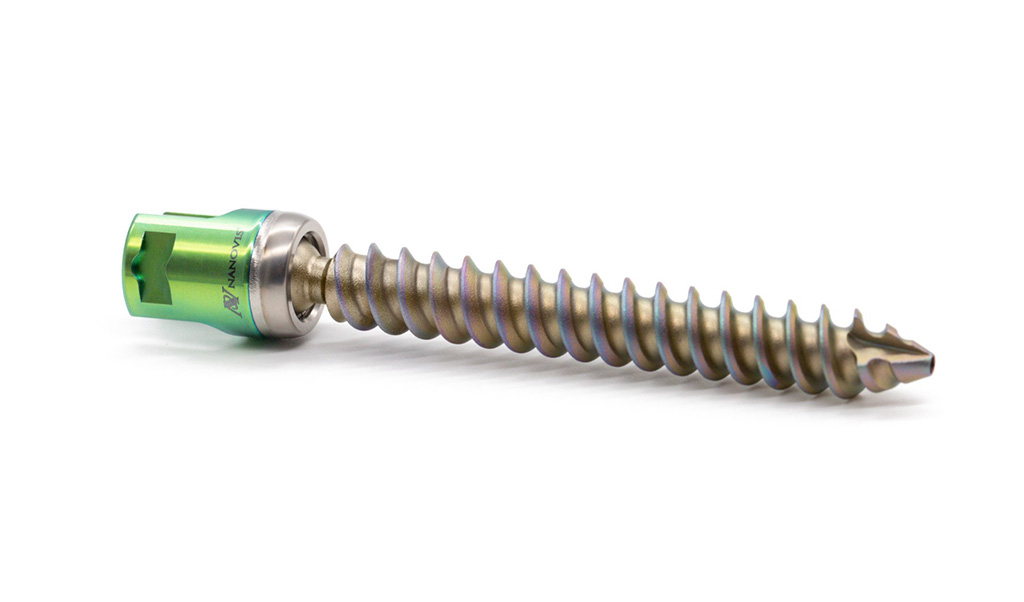 Image: The Nano FortiFix pedicle screw boasts a bioceramic nanotube surface (Photo courtesy of Nanovis).