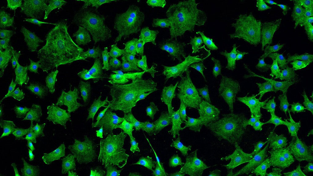 Image: Cardiosphere-derived cells (CDCs) (Photo courtesy of Cedars-Sinai)