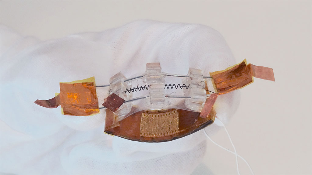 Image: An integrated sensing-actuation device controls bladder volume (Photo courtesy of NUS)
